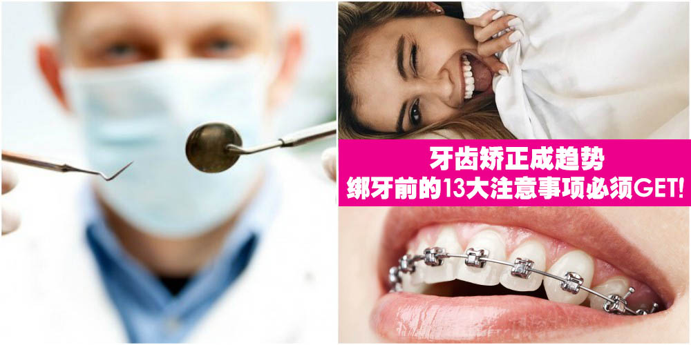 【变美前先绑牙？】牙齿矫正成趋势 · 绑牙前的13大注意事项必须GET！