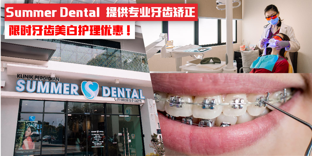 【Summer Dental提供专业牙齿矫正 限时牙齿美白护理优惠！】